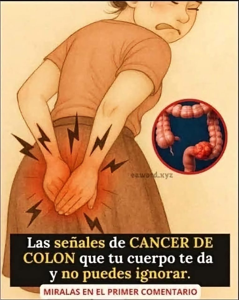 Cáncer de colon: síntomas tempranos, señales de alerta y cuándo consultar al médico