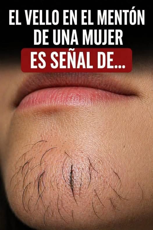 ¿Qué significa tener vello en el mentón siendo mujer? Causas, tratamientos y cuándo consultar al médico