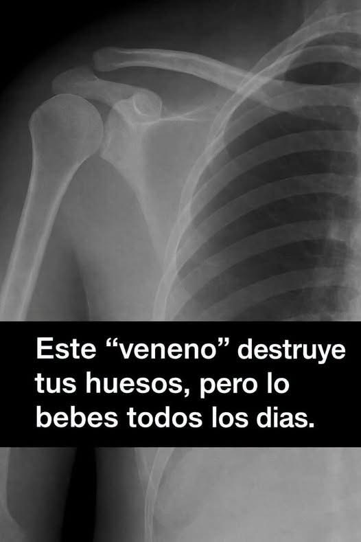 ¿Qué bebidas pueden afectar la salud de los huesos? Lo que dice la ciencia