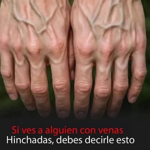¿Qué significan las venas visibles? Causas, cuándo son normales y cuándo consultar al médico