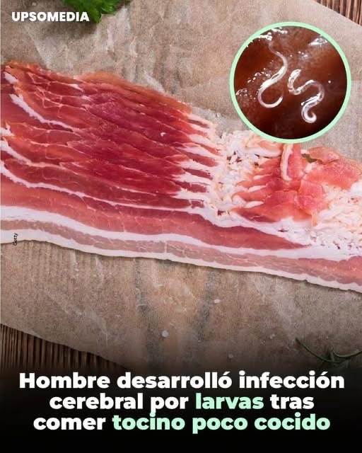 Tocino poco cocido: los riesgos reales para la salud y cómo prevenir infecciones