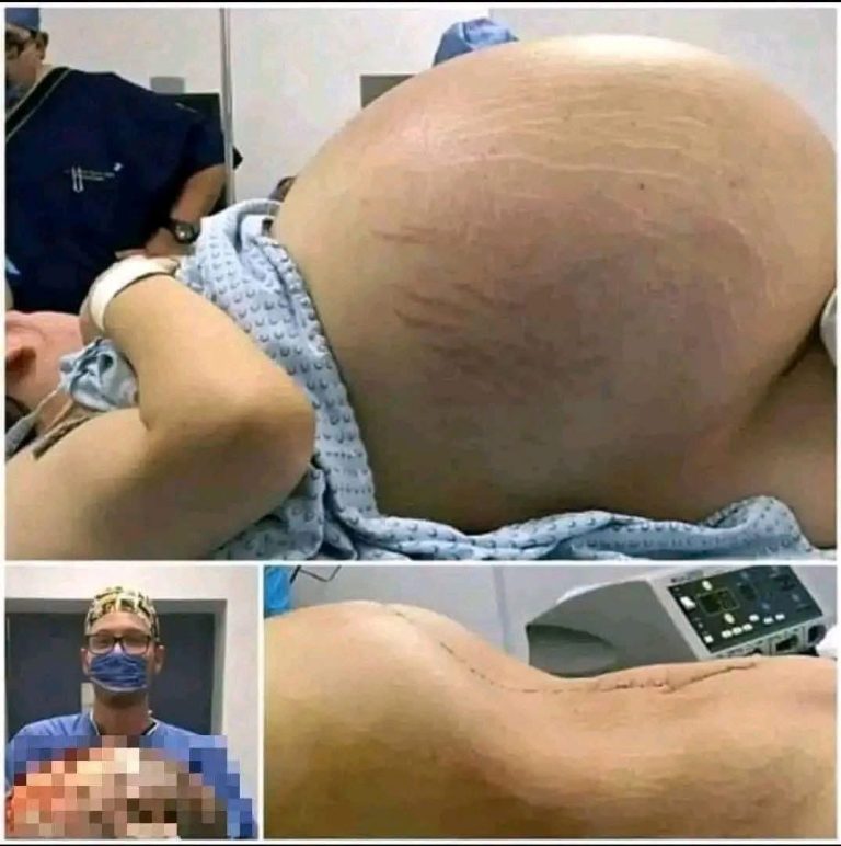 Abdomen grande durante el embarazo: causas, cuándo es normal y cuándo consultar al médico