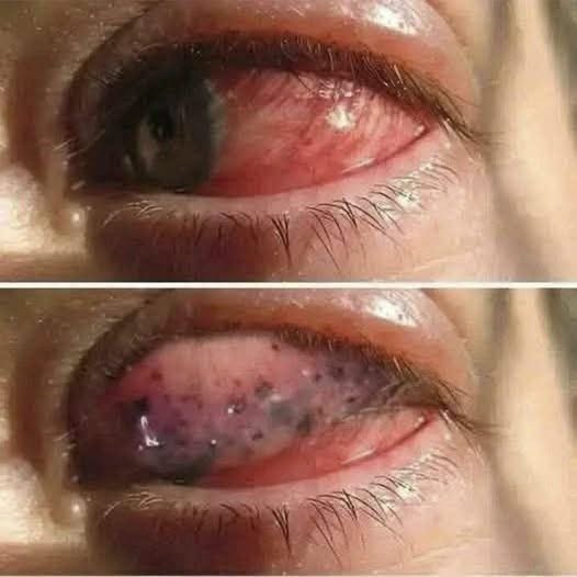¿Dormir con un ventilador puede dañar los ojos? Esto es lo que realmente dicen los especialistas