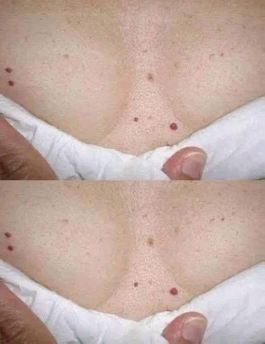 ¿Tienes pequeños puntos rojos en la piel? Esto es lo que realmente podrían significar