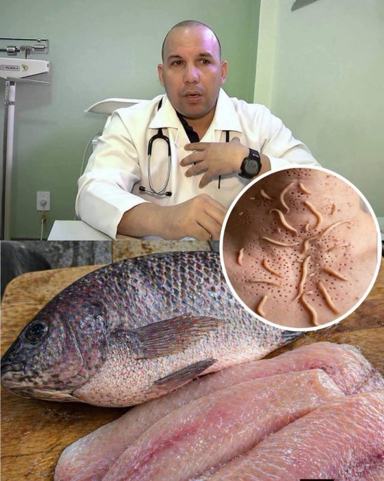 ¿La tilapia está llena de parásitos? Lo que realmente debes saber antes de consumir este pescado