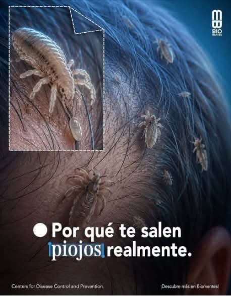 ¿Los piojos aparecen por falta de higiene? Esto es lo que realmente debes saber