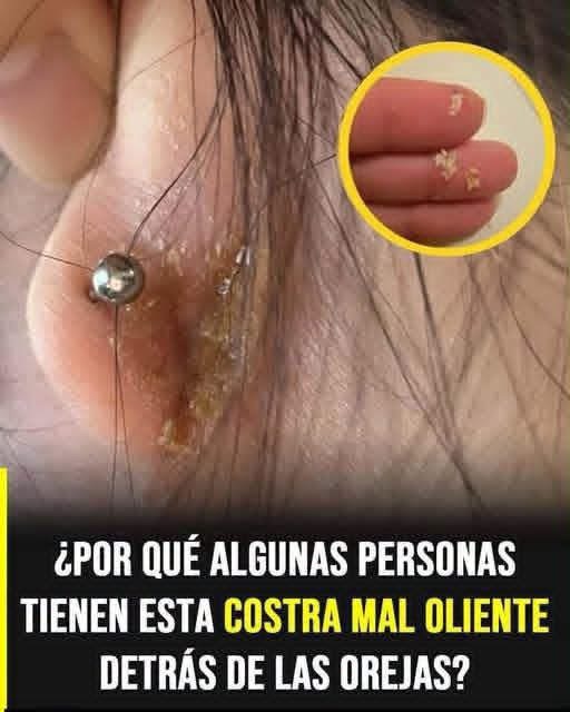 ¿Por qué aparecen costras detrás de las orejas? Causas, síntomas y cuándo consultar al médico