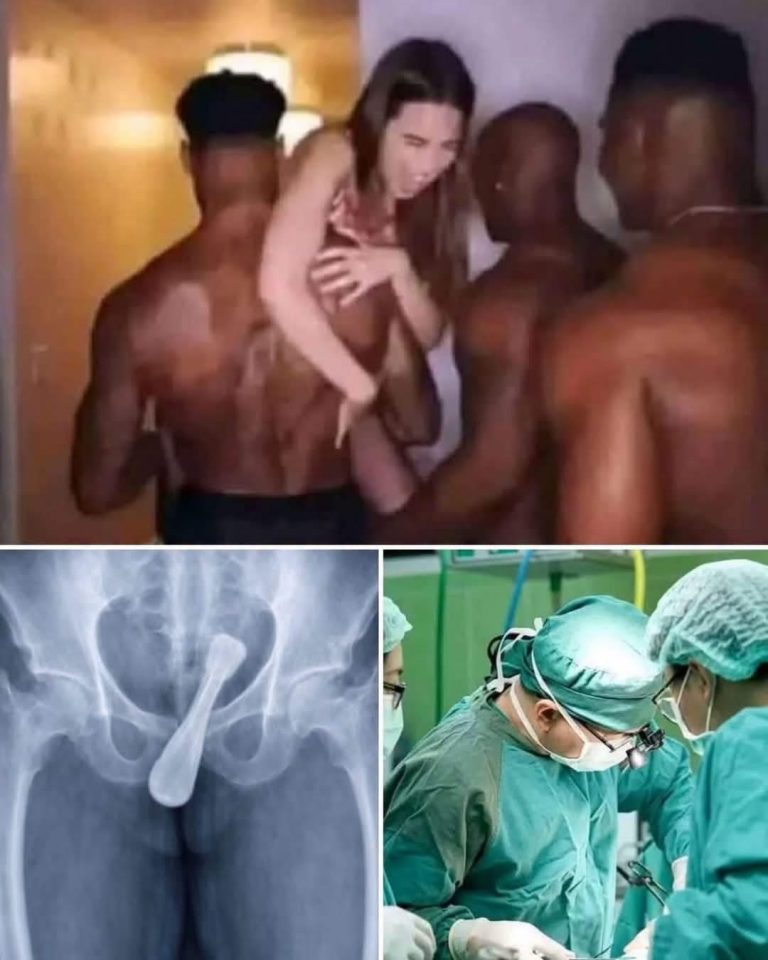 Objetos atrapados en el cuerpo: los riesgos reales detrás de las publicaciones virales y cuándo acudir de inmediato al hospital