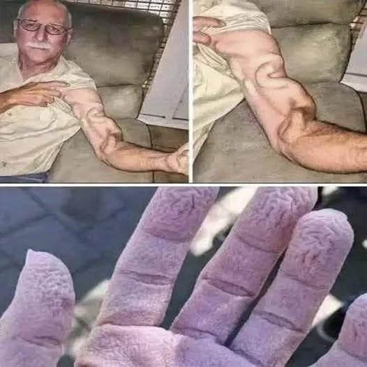 ¿Un dolor repentino en el brazo puede ser señal de cáncer? Lo que realmente dice la medicina
