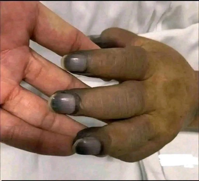 ¿Las uñas negras son consecuencia del esmalte? Esto es lo que realmente dicen los especialistas