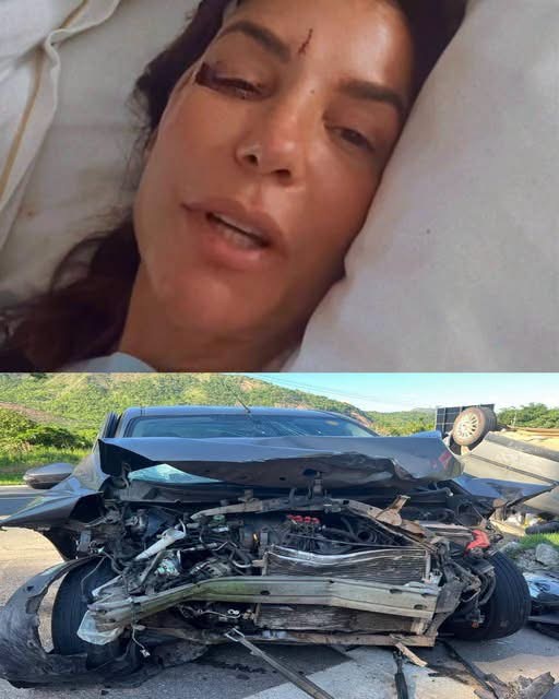 “Tras un accidente nuestra famosa cantante acaba de…”: qué se sabe realmente sobre la publicación viral