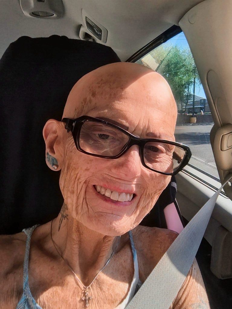 ¿Qué ocurrió realmente? La verdad detrás de la fotografía viral de una mujer con cáncer que circula en redes sociales