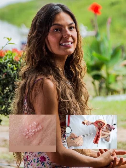 La verdad detrás de la supuesta enfermedad incurable atribuida a una actriz en redes sociales