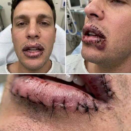 Lesiones y puntos en los labios: posibles causas, cuidados y señales de alerta