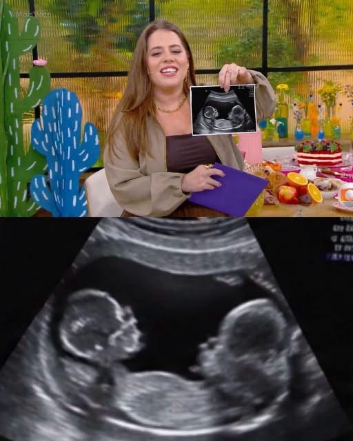 Tati Machado anuncia que será madre de un bebé: así compartió la emocionante noticia