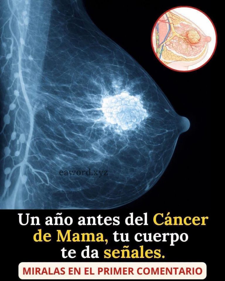 Signos tempranos del cáncer de mama: cambios que no debes ignorar y cuándo consultar al médico