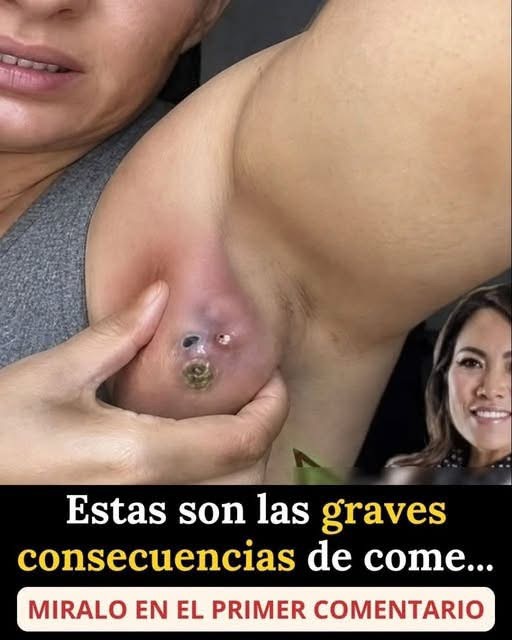 ¿Qué puede causar un bulto doloroso en la axila? Estas son las enfermedades que podrían estar detrás