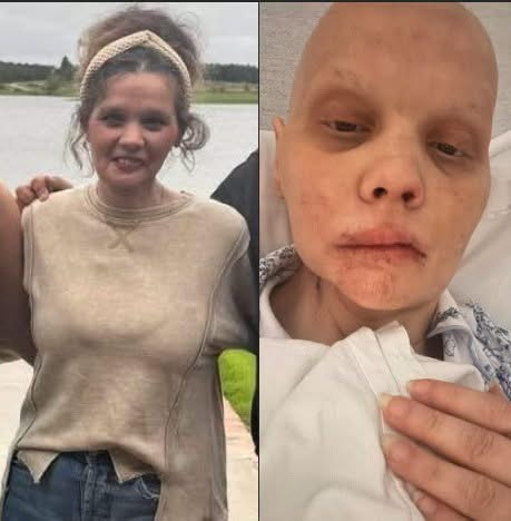 Madre enfrenta una nueva batalla contra el cáncer oral: la historia que está conmoviendo a miles