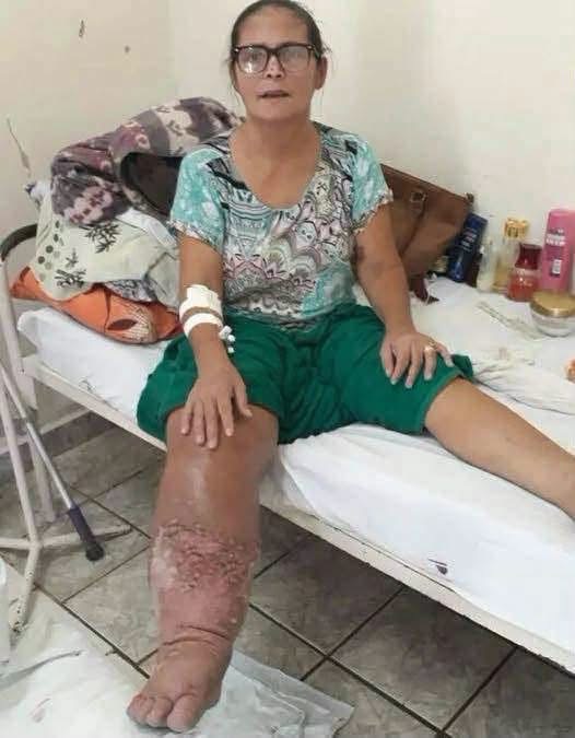 ¿Dormir con “algo” puede dejar una pierna así? La imagen viral no demuestra esa causa: estas son las posibilidades reales