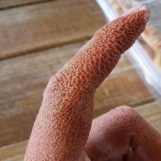 Dedos arrugados sin estar en el agua: cuándo es normal y qué señales requieren atención