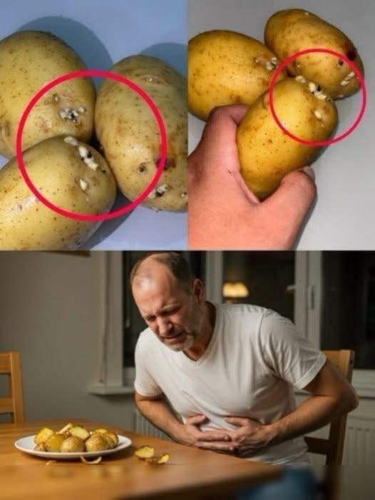 ¿Comer papas con brotes puede provocar intoxicación? Esto explican los especialistas