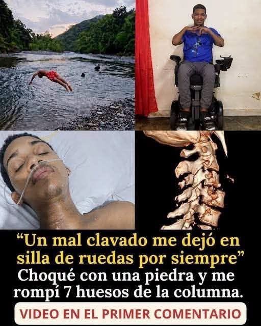 Un clavado en el río transformó su vida y ahora comparte una importante advertencia