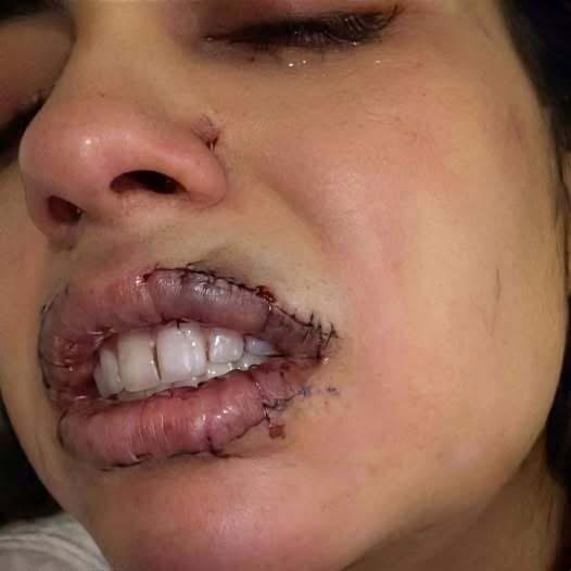 OCURRIÓ HACE APENAS UNOS SEGUNDOS: UNA JOVEN SUFRIÓ UN TERRIBLE INCIDENTE Y SU HISTORIA GENERÓ GRAN PREOCUPACIÓN