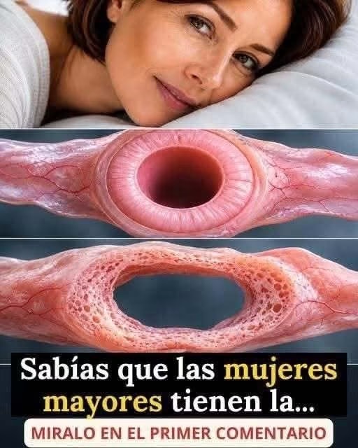Los cambios íntimos que pueden aparecer después de la menopausia y cómo tratarlos