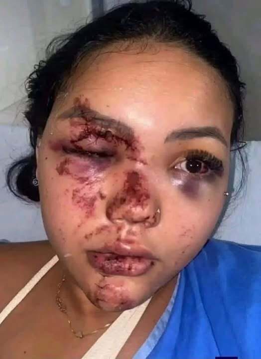 SU PAREJA REGRESÓ ANTES DE LO ESPERADO Y ENCONTRÓ UNA ESCENA QUE NO IMAGINABA… HORAS DESPUÉS ELLA TERMINÓ EN EL HOSPITAL