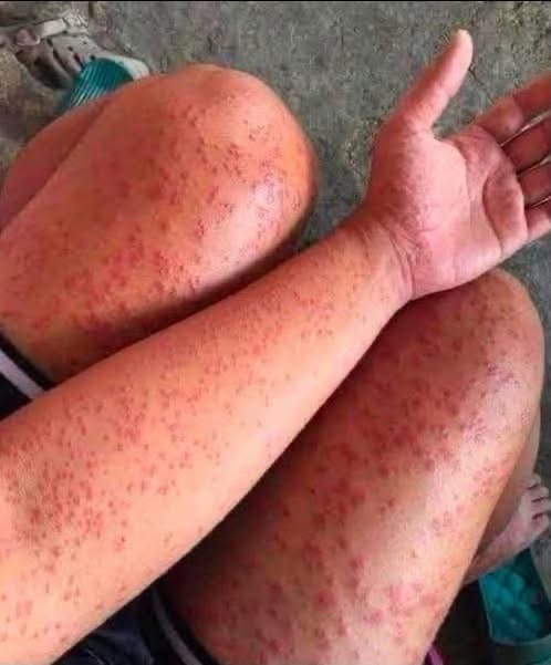 DORMIR CON MASCOTAS PARECE INOFENSIVO… PERO ESTOS RIESGOS PARA LA PIEL MERECEN ATENCIÓN