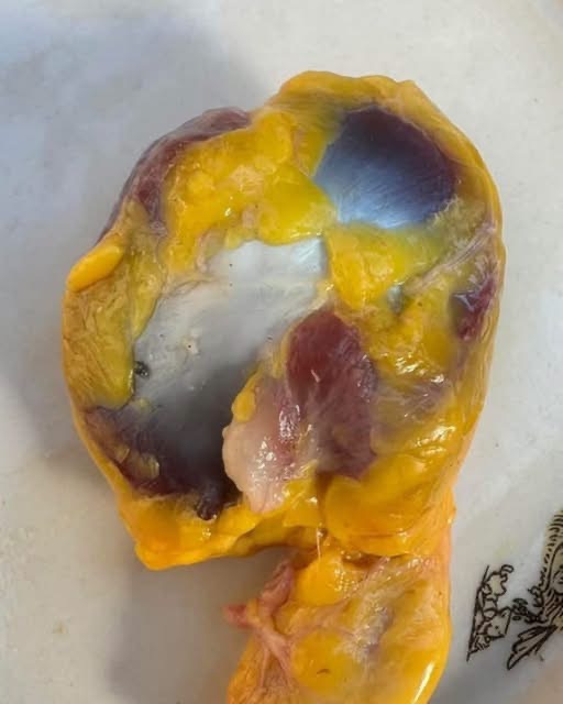 COMER MOLLEJAS DE POLLO PUEDE APORTAR NUTRIENTES IMPORTANTES… PERO NO SUSTITUYE AUTOMÁTICAMENTE NINGÚN SUPLEMENTO