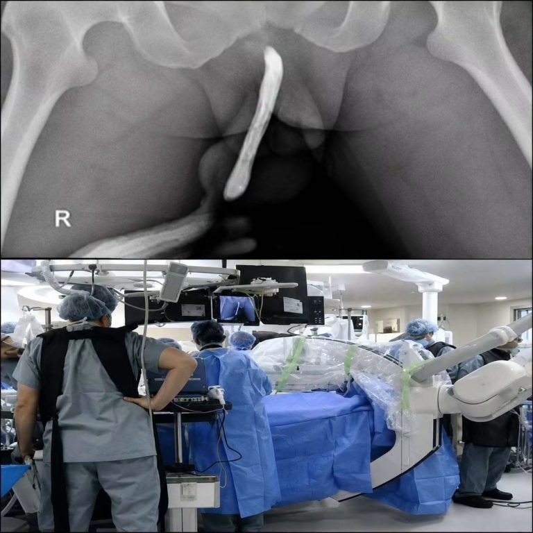 UNA RADIOGRAFÍA HOSPITALARIA SORPRENDE POR UN DETALLE INESPERADO… PERO LA IMAGEN NO CUENTA TODA LA HISTORIA