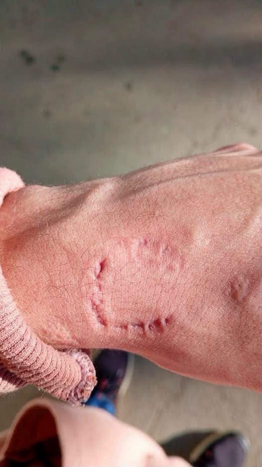 Estudiante termina con una lesión en la mano tras un confuso incidente dentro de una escuela